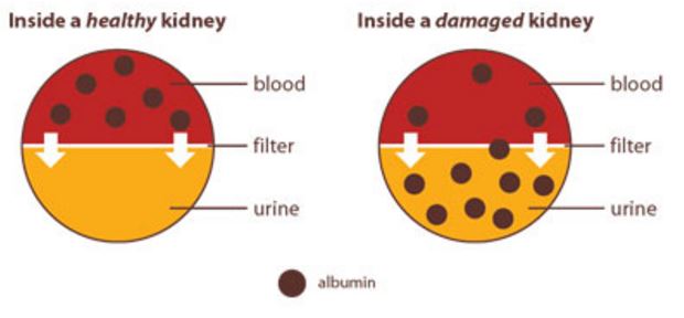 kidney albumin