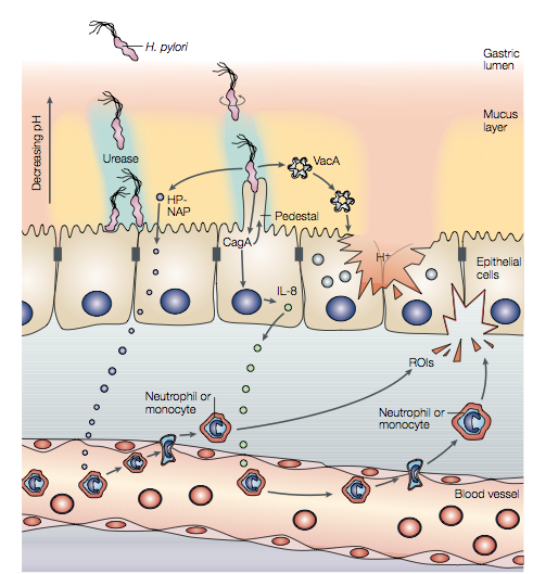 Stomach_mucosa_and_H.pylori - IgA Nephropathy